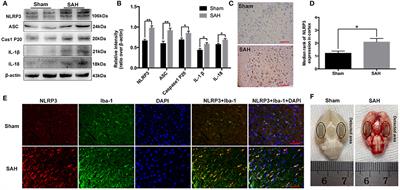 Resveratrol Attenuates Early Brain Injury after Experimental Subarachnoid Hemorrhage via Inhibition of NLRP3 Inflammasome Activation